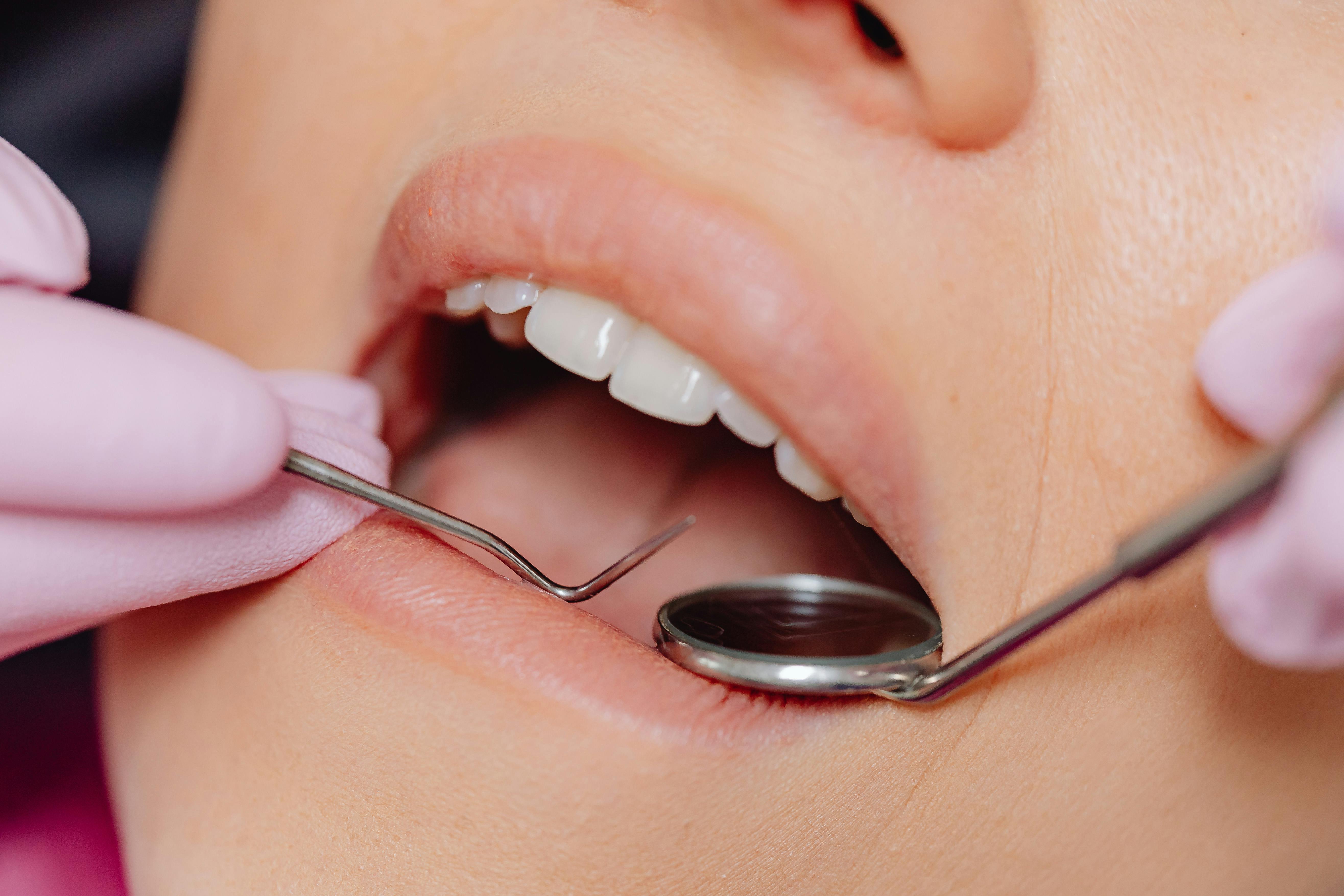 Zdjęcie przedstawia kobietę z otwartymi ustami, gdzie zagląda dentystka. Jak walczyć z paradontozą?