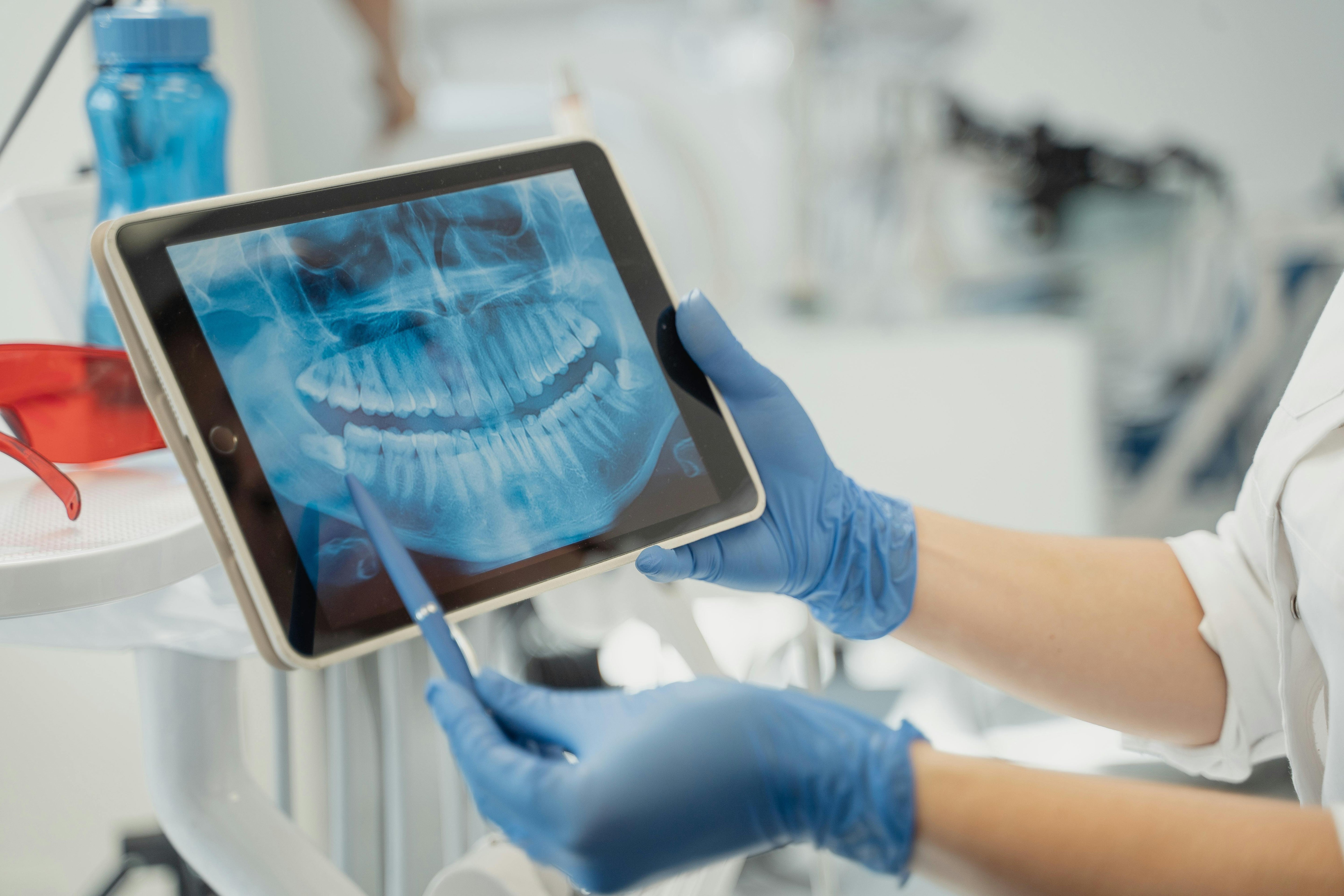 Dentysta pokazuje na tablecie skan RTG zębów pacjenta