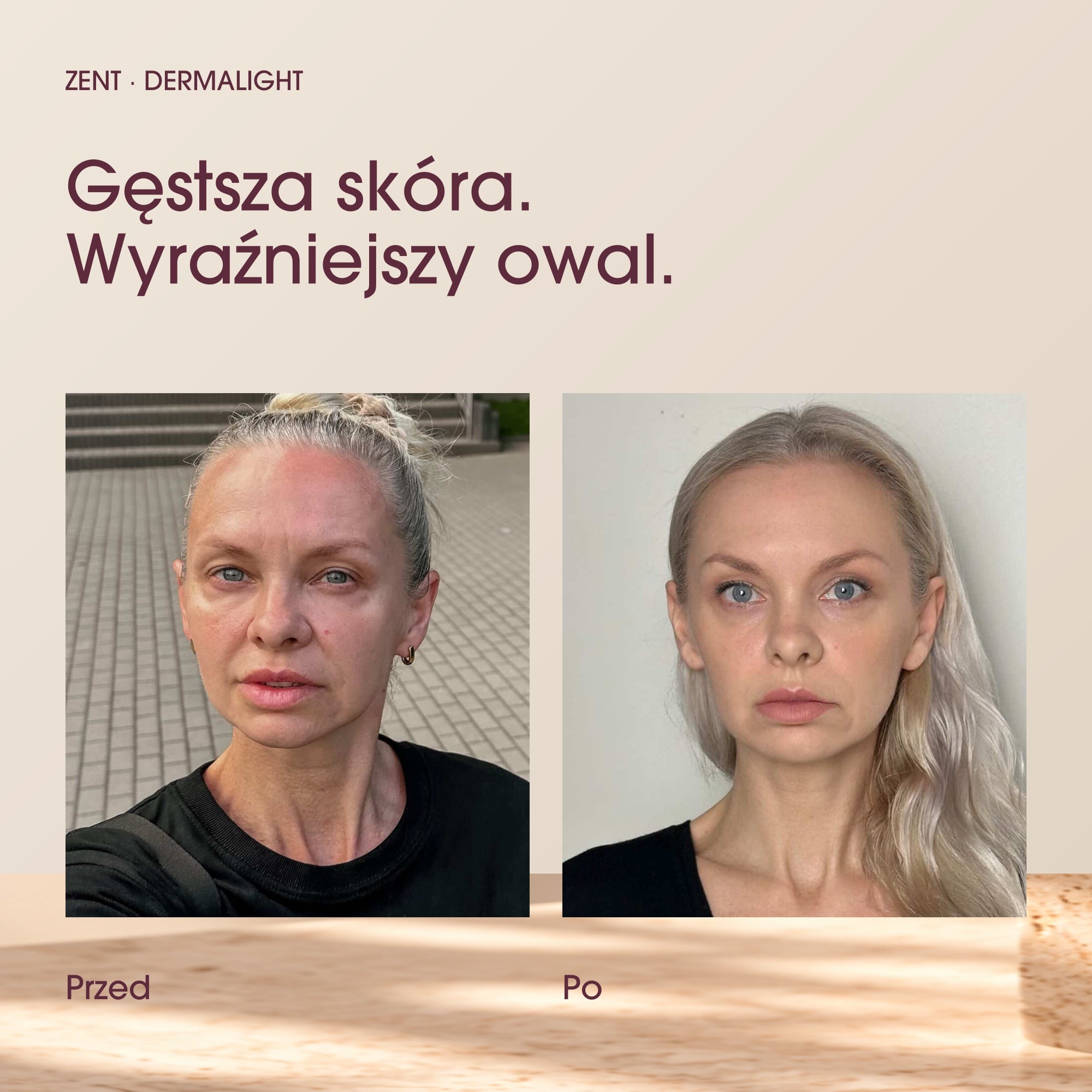 Przed i po stosowaniu DermaLight. Obecna para zdjęć efektów z landingu.