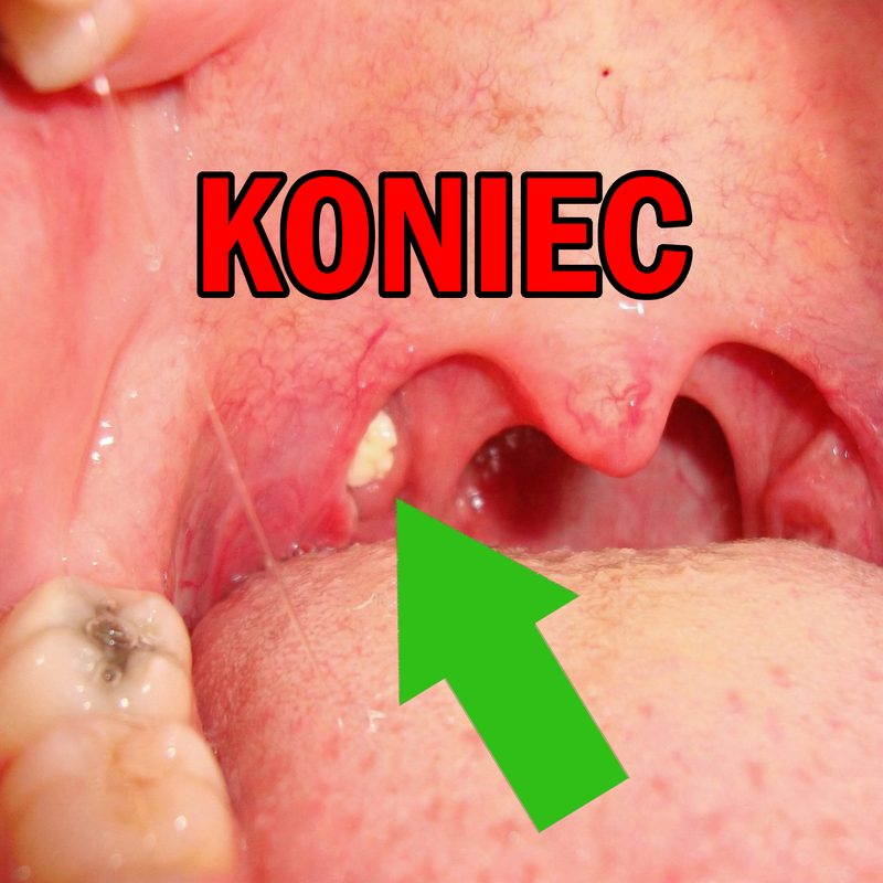 Pozbądź się problemu raz na zawsze