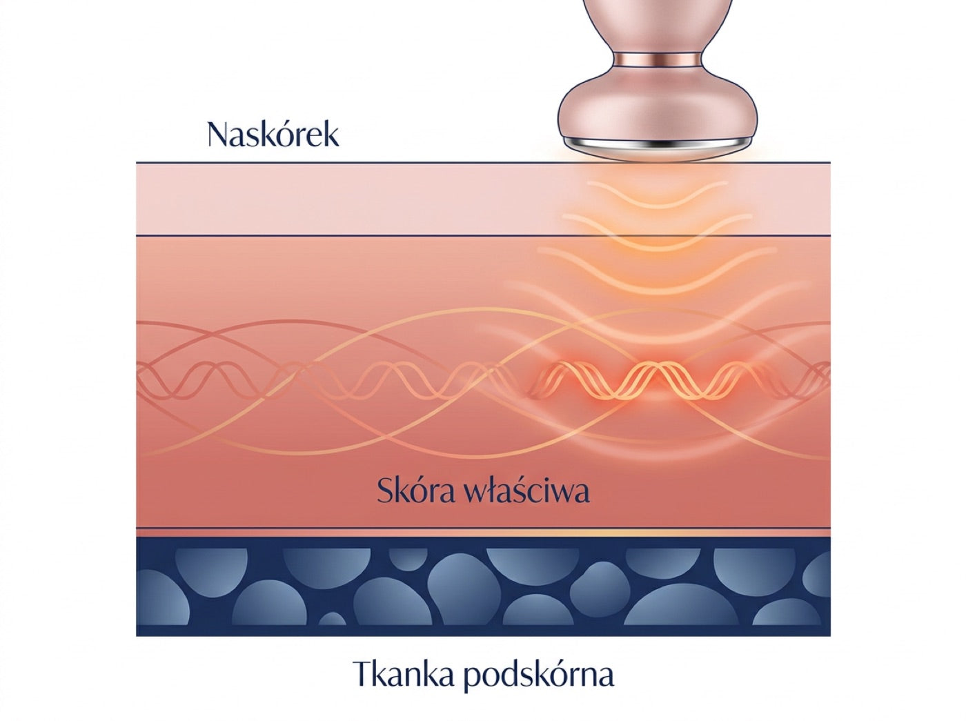 Ilustracja poglądowa. Krem zostaje w naskórku, a problem opornych partii siedzi w warstwie podskórnej, znacznie głębiej.